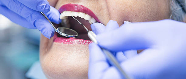 Best Emergency Tooth Extraction in Soh Willard, UT